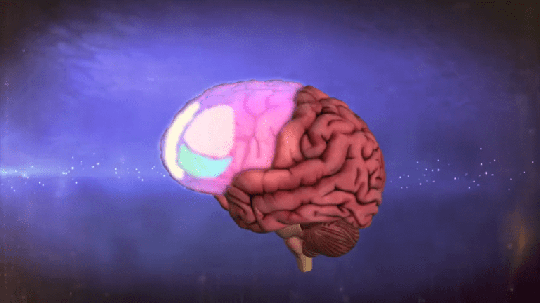 visual rendering of brain with ocd