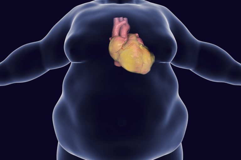 illustration of obese person's heart surrounded by fat