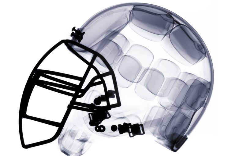 x-ray image of football helmet