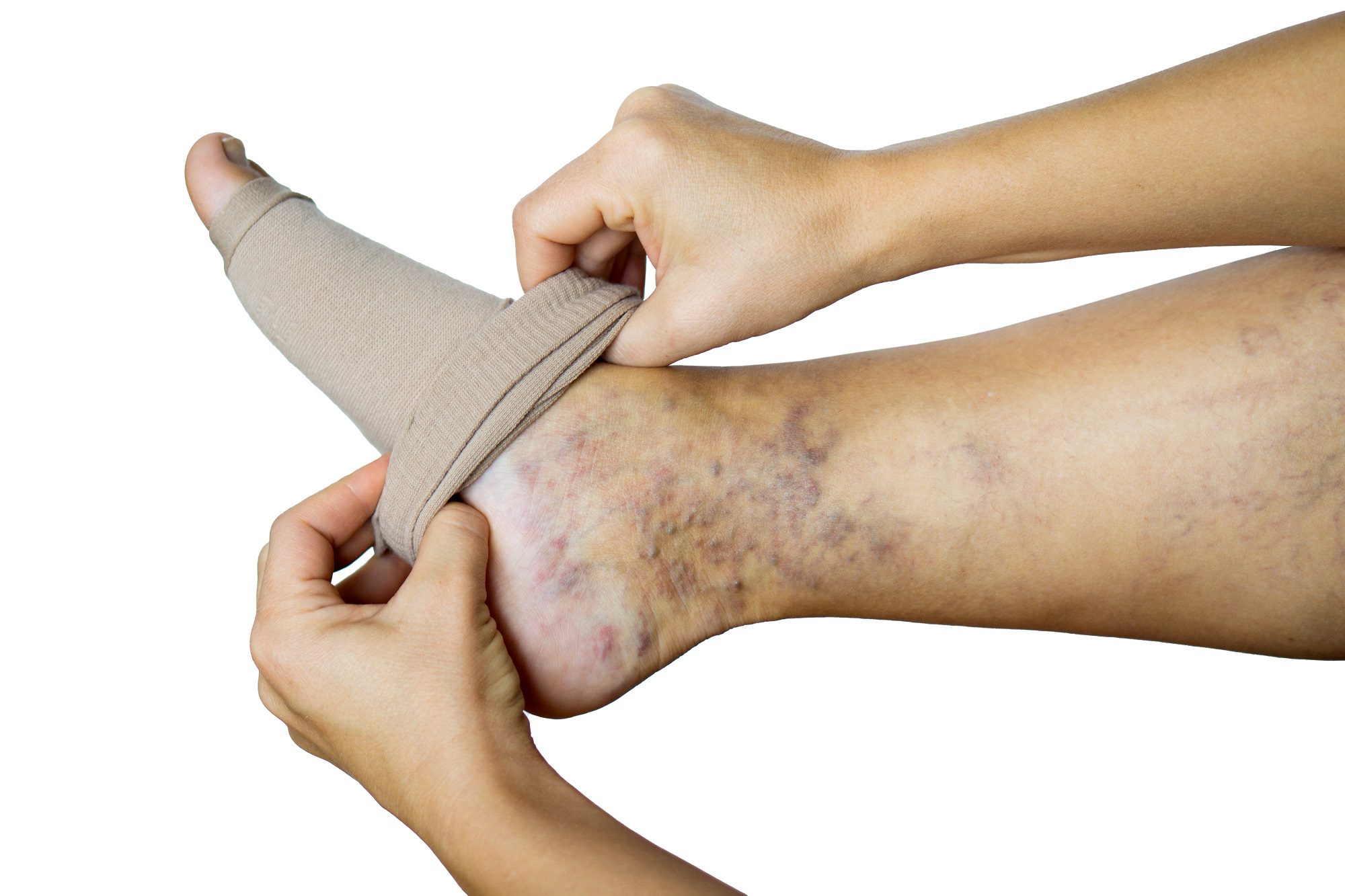 Ladies Compression Hosiery Leg Support Stockings Improve Varicose