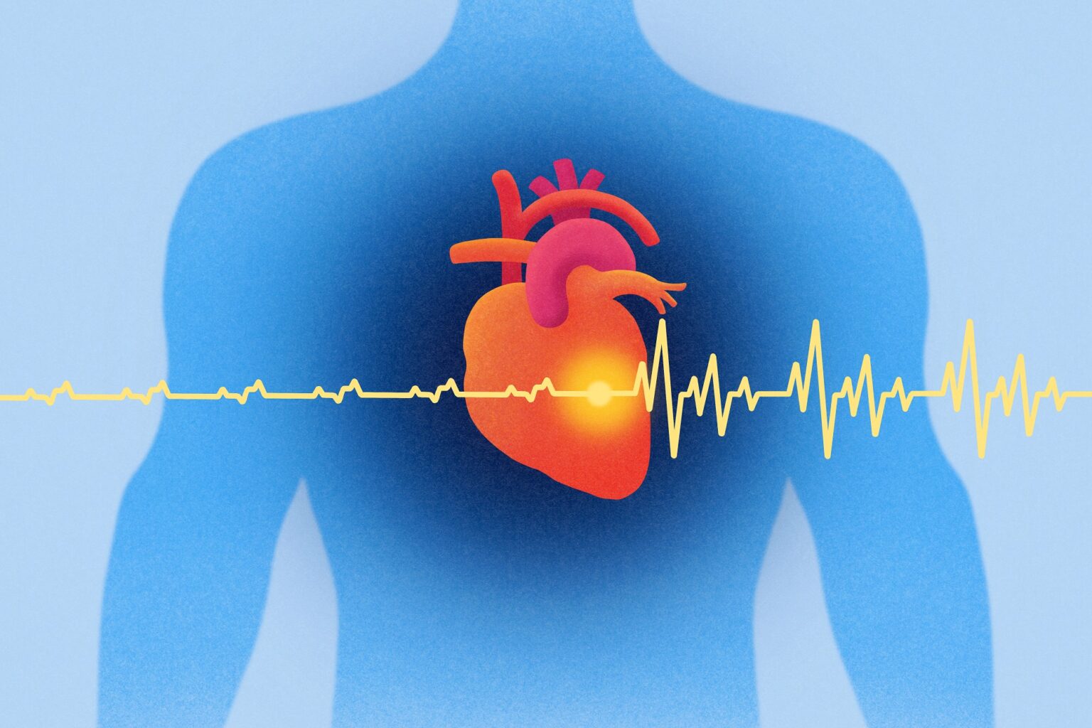 Find the Right AFib Treatment Options and Expertise - Advancing Your Health